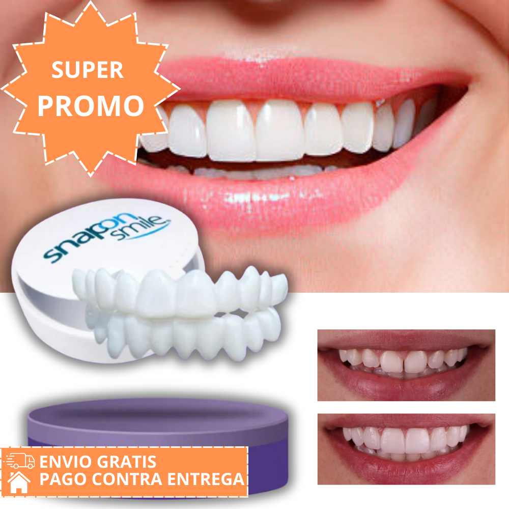 Snap-On Smile®: Carillas Dentales Ajustables - Dientes de Cerámica